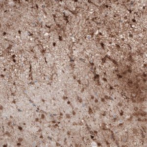 Monoclonal Anti-S100B antibody produced in mouse 