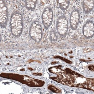 Monoclonal Anti-SAA1 antibody produced in mouse AMAB91543-100UL