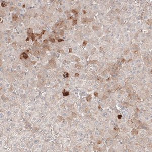 Monoclonal Anti-SAA1 antibody produced in mouse AMAB91543-100UL