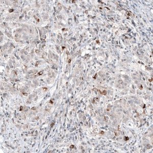 Monoclonal Anti-SCGB2A2 antibody produced in mouse AMAB91536-100UL