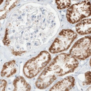 Monoclonal Anti-SDHB antibody produced in mouse 