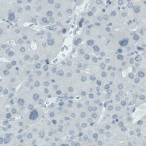 Monoclonal Anti-SLC27A5 antibody produced in mouse 