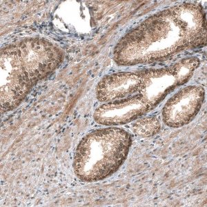 Monoclonal Anti-SMAD4 antibody produced in mouse AMAB91594-100UL