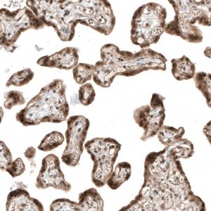 Monoclonal Anti-SMAD4 antibody produced in mouse AMAB91594-100UL