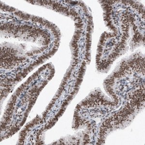 Monoclonal Anti-SMCHD1 antibody produced in mouse 