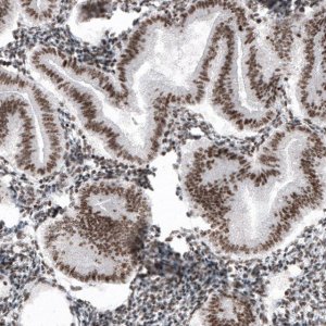 Monoclonal Anti-SMCHD1 antibody produced in mouse 