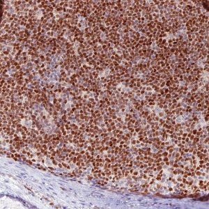 Monoclonal Anti-SOX11 antibody produced in mouse 