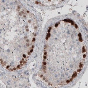 Monoclonal Anti-SSX2 antibody produced in mouse 