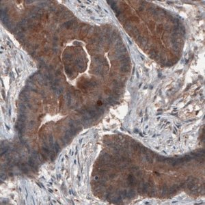 Monoclonal Anti-ST13 antibody produced in mouse 