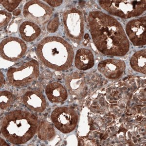 Monoclonal Anti-ST13 antibody produced in mouse 