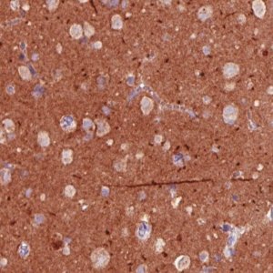 Monoclonal Anti-TSPAN7 antibody produced in mouse 