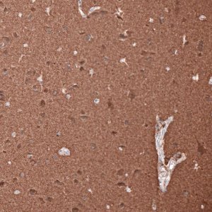 Monoclonal Anti-TUBB3 antibody produced in mouse 