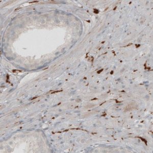 Monoclonal Anti-UCHL1 antibody produced in mouse 