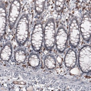 Monoclonal Anti-VSIR antibody produced in mouse 