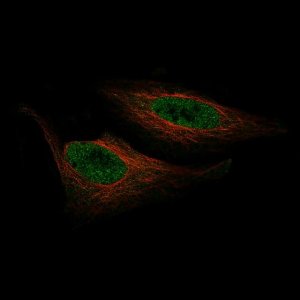 Monoclonal Anti-ZNF10 antibody produced in mouse AMAB91592-100UL