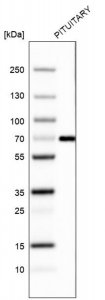 Monoclonal Anti-ZNF10 antibody produced in mouse AMAB91592-100UL