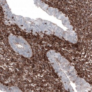 Monoclonal Anti-ZYX antibody produced in mouse 