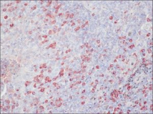 Anti-Chicken IgY (IgG) (whole molecule)Peroxidase antibody produced in rabbit A9046-1ML