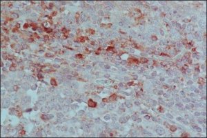 Anti-Horse IgG (whole molecule)Peroxidase antibody produced in rabbit A9292-2ML