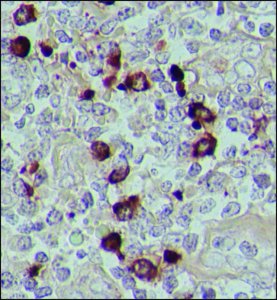 Anti-Human IgA (-chain specific)Peroxidase antibody produced in goat A0295-1ML