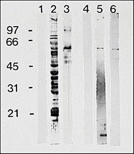 Anti-Human IgG (-chain specific)Peroxidase antibody produced in goat 