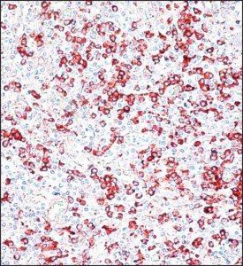 Anti-Human IgG (-chain specific)Peroxidase antibody produced in goat A8419-2ML