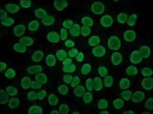 Anti-Human IgG (Fab specific)FITC antibody produced in goat 