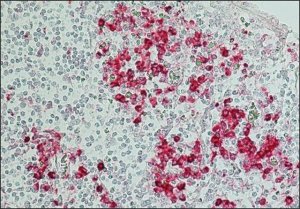 Anti-Human IgG (Fc specific)Alkaline Phosphatase antibody produced in goat 