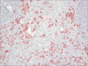 Anti-Human IgG (Fc specific)Peroxidase antibody produced in goat A0170-1ML