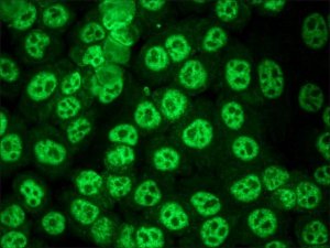 Anti-Human IgG (whole molecule)FITC antibody produced in goat 