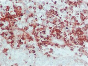 Anti-Human IgG (whole molecule)Peroxidase antibody produced in goat A8667-2ML