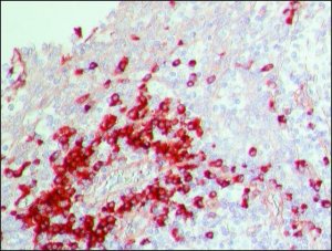 Anti-Human IgG (whole molecule)Peroxidase antibody produced in rabbit A8792-2ML