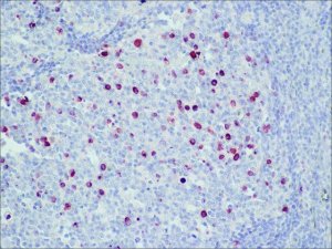 Anti-Human IgM (-chain specific)Peroxidase antibody produced in goat A0420-1ML