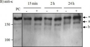 Anti-Human Kappa Light Chains (Bound and Free)Peroxidase antibody produced in goat 