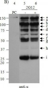 Anti-Human Kappa Light Chains (Bound and Free)Peroxidase antibody produced in goat 