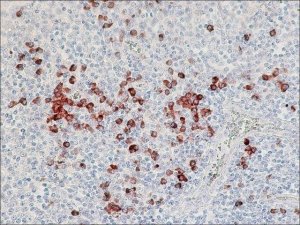 Anti-Human Lambda Light Chains (Bound and Free)Peroxidase antibody produced in goat A5175-1ML
