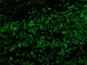 Anti-Human Polyvalent Immunoglobulins (whole molecule)FITC antibody produced in rabbit 