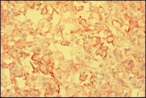 Anti-Mouse IgM (-chain specific)Peroxidase antibody produced in goat 