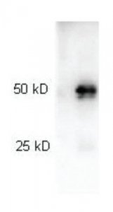Anti-Rabbit IgG (H+L), highly cross adsorbed-Peroxidase antibody produced in goat SAB3700885-2MG