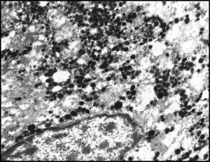 Anti-Rabbit IgG (whole molecule)Gold antibody produced in goat 