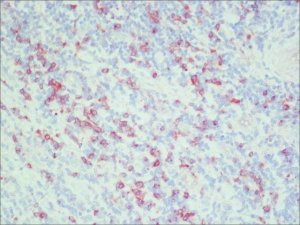 Anti-Rat IgG (whole molecule)Peroxidase antibody produced in rabbit A5795-1ML