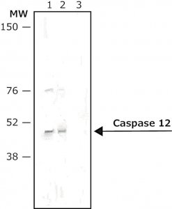 Anti-Rat IgG (whole molecule)Alkaline Phosphatase antibody produced in rabbit 