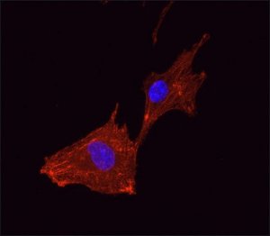 Anti- Actinin antibody, Mouse monoclonal 