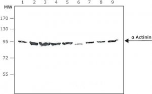 Anti- Actinin antibody, Mouse monoclonal 