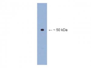Anti- III tubulin Antibody 