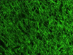 Anti- Neurofilament 200-FITC antibody, Mouse monoclonal 