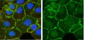 Anti--Catenin Antibody 