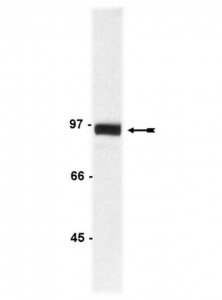 Anti--Catenin Antibody 