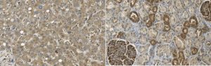 Anti-Acetyl CoA Carboxylase 1 
