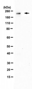 Anti-Acetyl CoA Carboxylase 1 